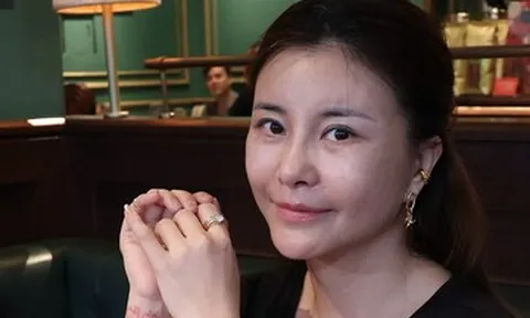 Diễn viên Kim Oanh chi tiền tỷ thẩm mỹ gương mặt, sống độc thân không cầu tình duyên