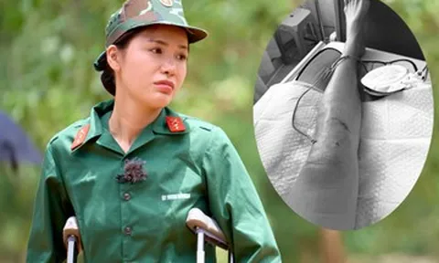 Siêu mẫu Minh Tú chấn thương nghiêm trọng, bác sĩ lên tiếng cảnh báo