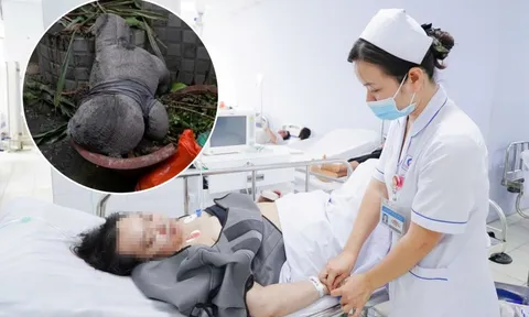 Vụ cháy 4 người chết ở TP.HCM: Một câu nói khiến cô gái quyết định nhảy từ tầng 3 xuống đất!