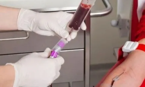 Nhiều tồn tại trong công tác tiếp nhận và cung cấp máu