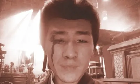 Diễn viên tố đoàn phim bỏ mặc sau tai nạn phải khâu 6 mũi