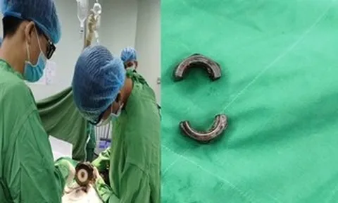 Bác sĩ tại Cần Thơ dùng máy cắt cứu người đàn ông ở An Giang gặp nạn vì “nâng cấp dương vật"