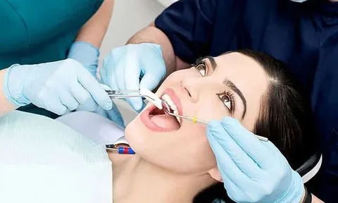 Đi nhổ răng có được bảo hiểm y tế chi trả?