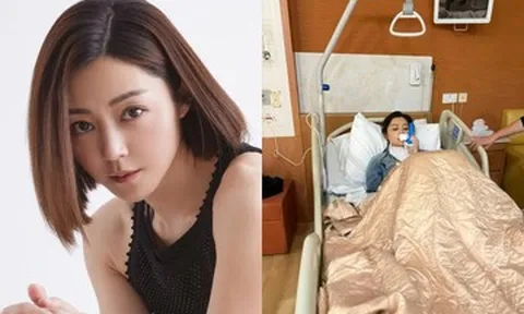 Nữ diễn viên 42 tuổi khâu hơn 50 mũi sau tai nạn trên phim trường